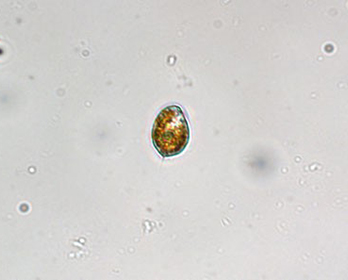 Heterosigma akashiwo Photo credit: Kudela lab, UC Santa Cruz.