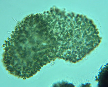 Microcystis colony Photo credit: Janis Cooke, Central Valley Regional Water Board.