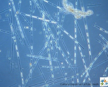 Pseudo-nitzschia Photo credit: California Department of Public Health Marine Biotoxin Monitoring Program.